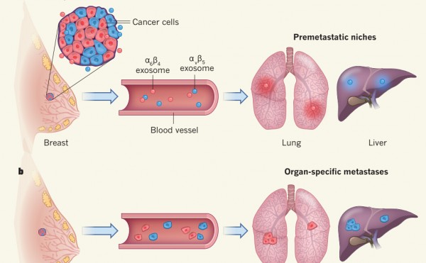 Nature：外泌体整合素分子决定了肿瘤转移的器官倾向性