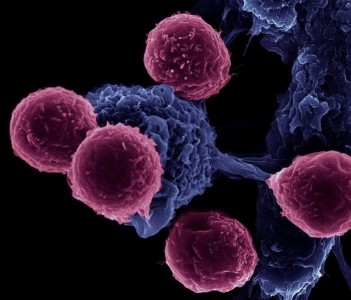 肿瘤微环境中的外泌体会多方面调控肿瘤细胞的代谢