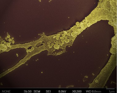 【重磅】Nature biotechnology：外泌体癌症诊断市场应用总结