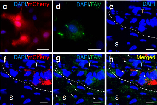 Nature Communications: 外泌体miR21使卵巢癌细胞产生紫杉醇抗药性