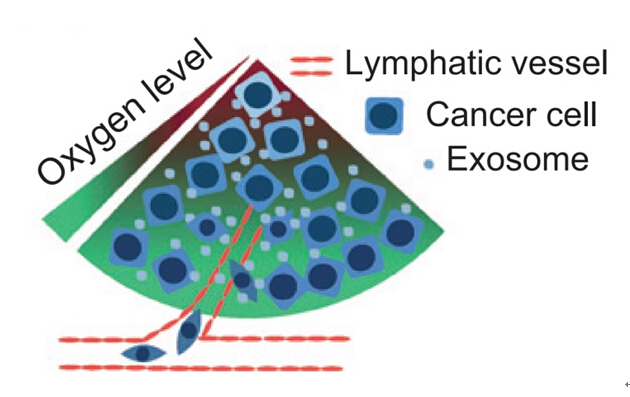 Cancer Research: 缺氧口腔鳞状细胞癌来源的外泌体促进常氧细胞转移