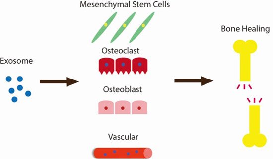外泌体：促进骨再生的新方法
