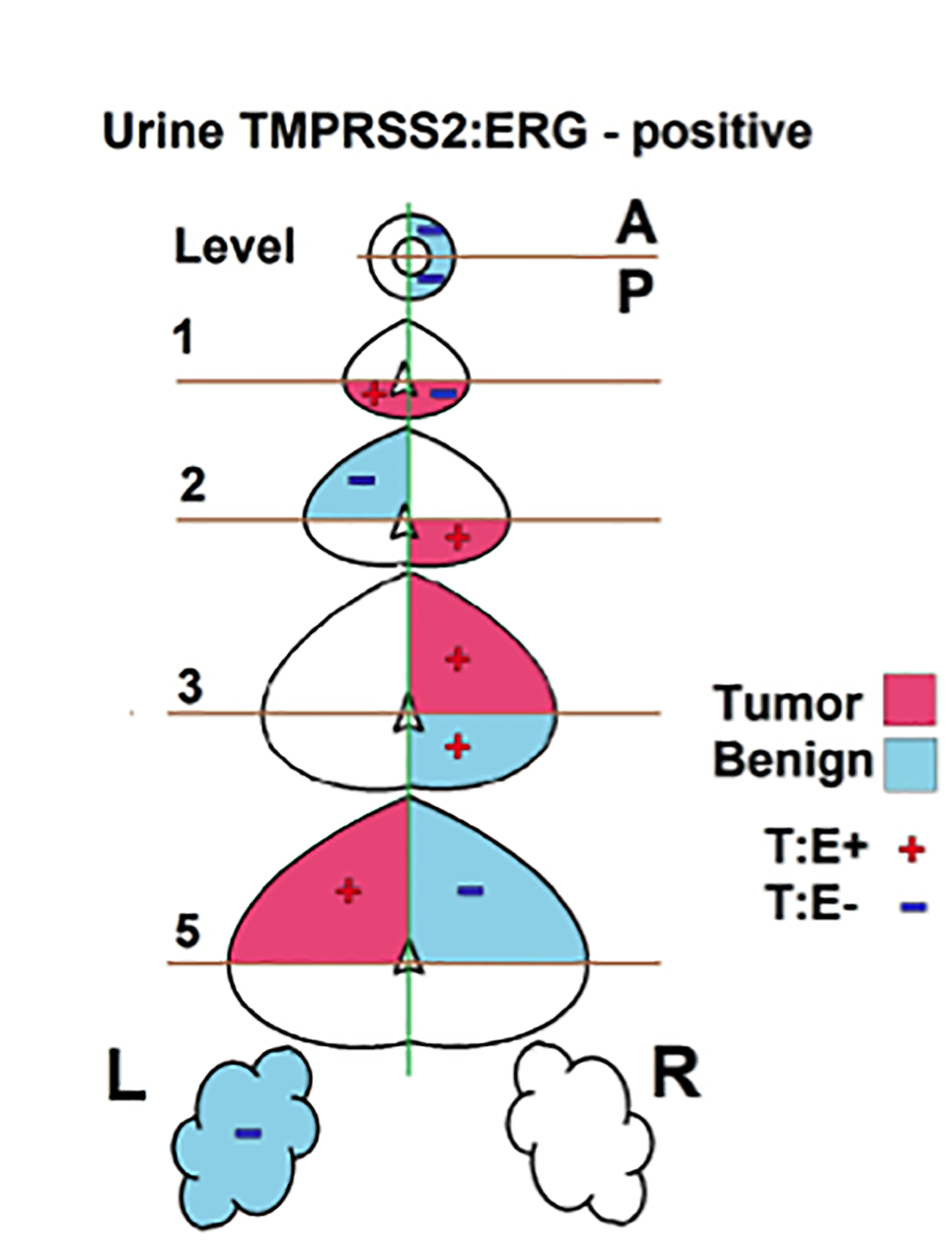 tmp-1