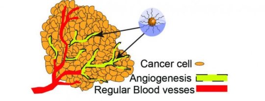一种能够消灭癌细胞、帮助机体恢复抗癌能力的癌症治疗方案