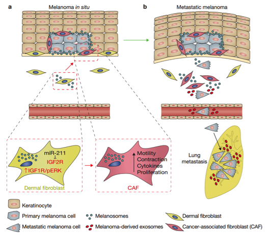 Nature cell biology：黑色素瘤通过黑色素小体传递miRNA至真皮成纤维细胞促进真皮层肿瘤龛结构形成