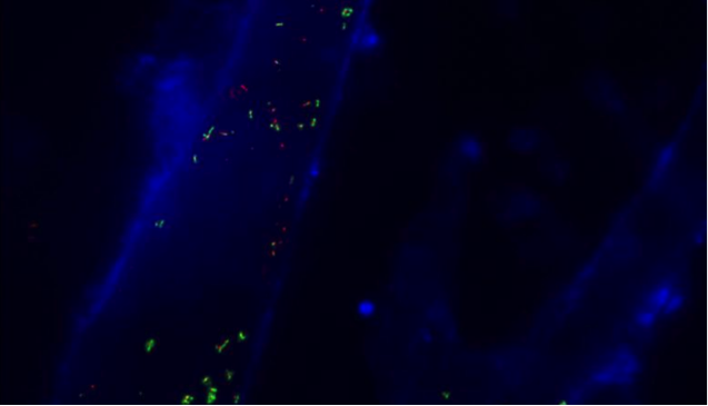 东南大学：超分辨率荧光显微镜技术成功运用于外泌体的成像和追踪