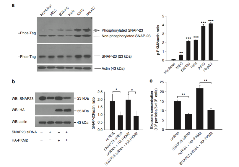 Nature Communications：PKM2磷酸化SNAP-23促进肿瘤外泌体的释放