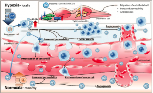 Oncogene：缺氧条件下肺癌细胞分泌的外泌体miR-23a增强血管生成和血管通透性