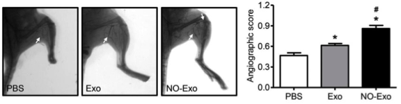 【Biomaterials】南开大学：一氧化氮增强MSC外泌体的促血管新生能力