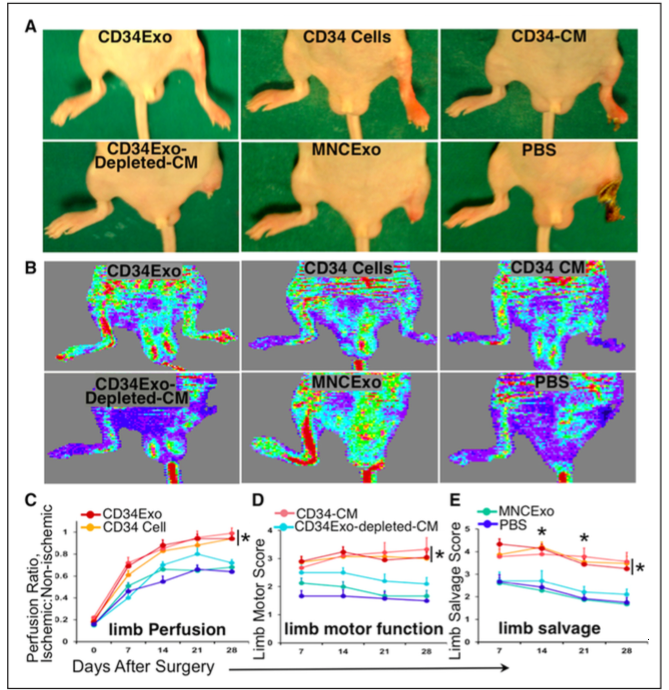Circ Res：CD34阳性干细胞分泌的外泌体在肢体缺血修复中的机制