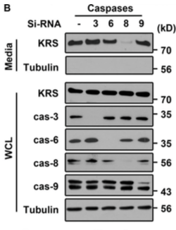 JCB：Caspase-8调控癌细胞外泌体中赖氨酰-tRNA合成酶的分泌