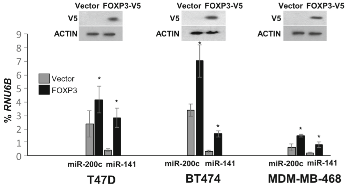 吉林大学第二医院&阿拉巴马大学伯明翰分校：FOXP3调控的miR-200可作为乳腺癌转移标志物