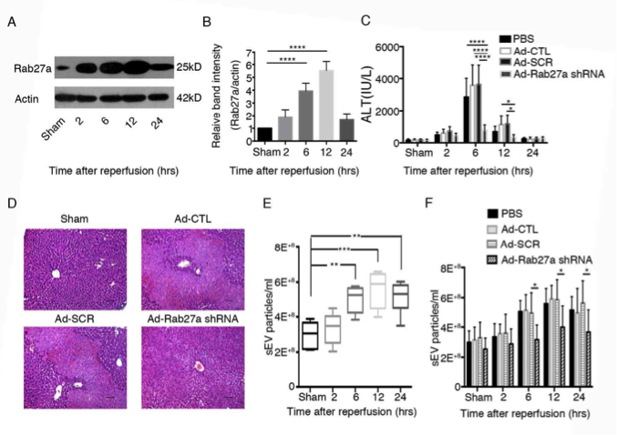 肝脏缺血再灌注损伤中IRF1-Rab27a促进细胞外膜泡分泌并通过EVs表面的氧化磷脂加重肝脏损伤