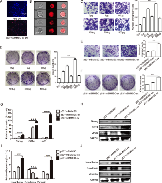 江苏大学钱晖、许文荣团队又出新作：p53缺失的小鼠骨髓MSC外泌体富含UBR2通过Wnt/β-Catenin途径胃癌的进展