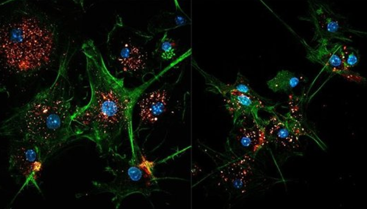 【Nature Methods】瑞士洛桑联邦理工学院研究人员开发出一种利用外泌体加强免疫系统识别和攻击肿瘤的有效方法