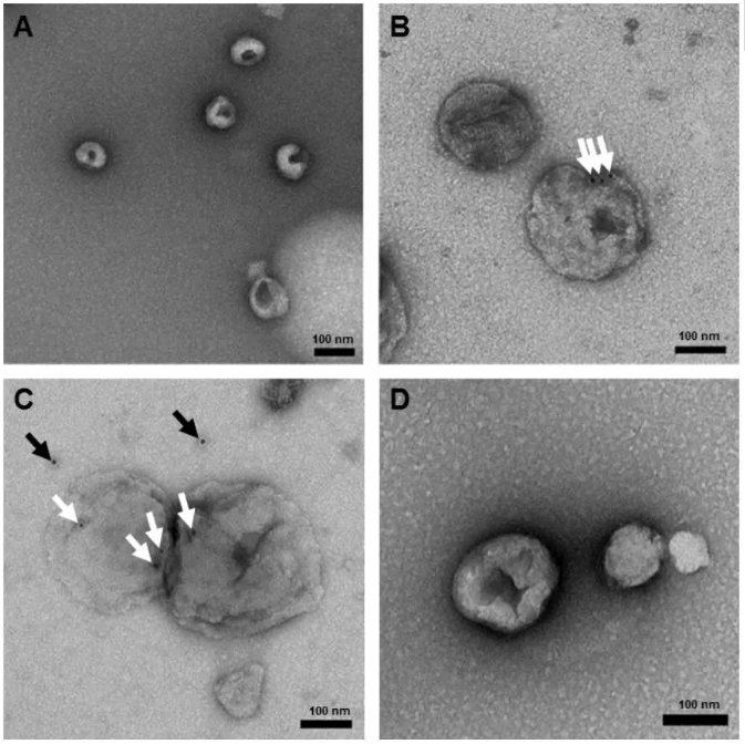 【视频】外泌体电镜protocol