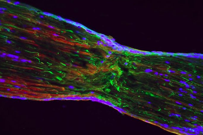 Nat Cell Biol | 外泌体通过传递活性氧帮助神经修复再生