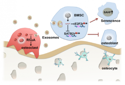 Aging Cell：南京医科大学发现衰老相关的骨髓微环境中外泌体miR-31a-5p调节骨形成和骨吸收