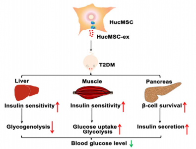 人间充质干细胞来源的外泌体通过逆转胰岛素抵抗和缓解β细胞损伤从而减轻II型糖尿病