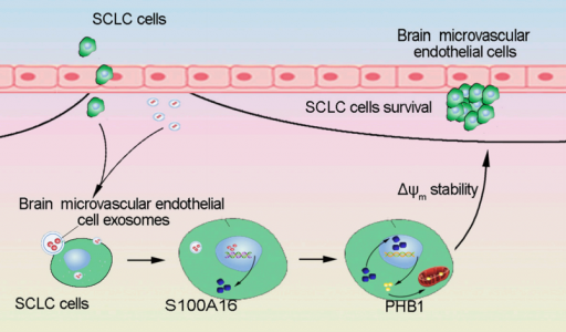 中国医科大学：脑微血管内皮细胞外泌体介导小细胞肺癌细胞的脑转移