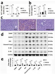 浙江大学医学院：AMSC衍生的外泌体减少巨噬细胞中TXNIP / NLRP3炎性体激活来减轻急性肝衰竭