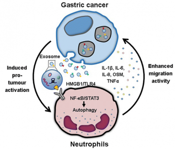 江苏大学医学院：肿瘤来源的外泌体诱导中性粒细胞的N2极化以促进胃癌细胞迁移