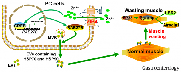 ZIP4调节癌细胞胞外囊泡的释放，促进原位胰腺肿瘤小鼠的肌肉萎缩和恶病质 | Gastroenterology