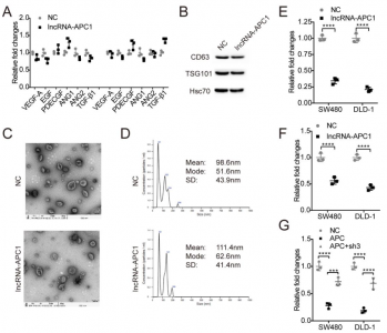 【JCI】中山大学肿瘤医院谢丹/徐瑞华组：lncRNA-APC1减少外泌体产生抑制结直肠癌进展