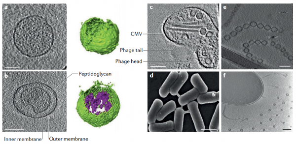 细菌膜囊泡的类型和形成机制| Nature Reviews Microbiology