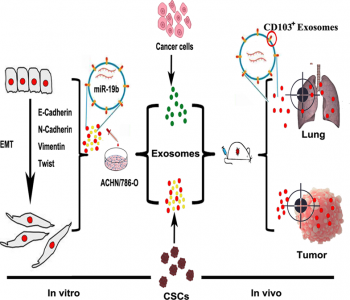 哈尔滨医科大学附属第四医院：CD103阳性的肿瘤干细胞外泌体促进肾透明细胞癌的EMT进程和肿瘤转移