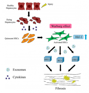 华中科技大学同济医学院：活化肝星状细胞分泌外泌体影响肝脏非实质细胞的代谢状态