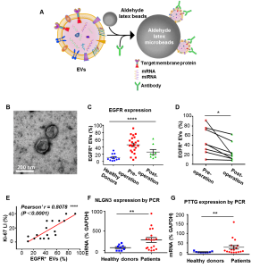 [Theranostics]国家纳米科学中心：微球富集联合流式细胞术的血清细胞外囊泡检测用于胶质瘤无创诊断