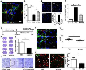 【Theranostics】上海交通大学：M2型小胶质细胞衍生的外泌体通过传递miR-124保护小鼠大脑免受缺血再灌注损伤