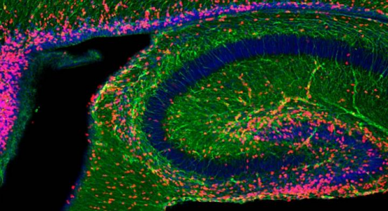 PNAS：外泌体或可用于治疗Rett综合征