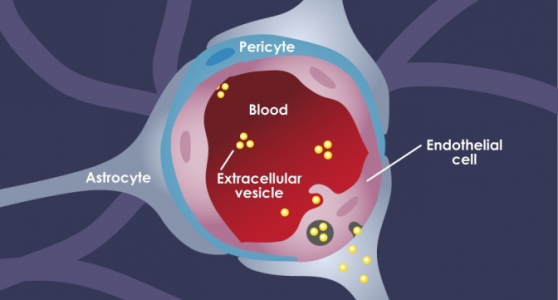 ACS Nano：乳腺癌细胞如何利用外泌体实现向大脑的肿瘤转移？