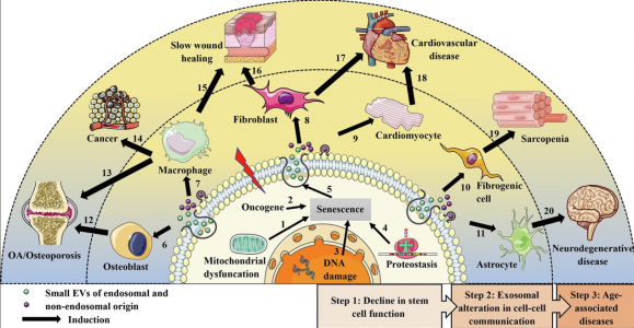 浙江大学研究人员综述：干细胞衍生的外泌体用于治疗年龄相关的肌肉骨骼疾病