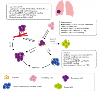 上海中医药大学综述：外泌体在肺癌中的生物学功能和临床应用