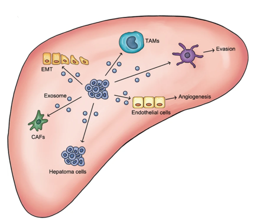 中国医科大学综述：外泌体在肝癌发生中的作用和诊断治疗潜力