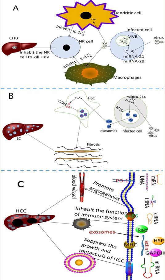 首都医科大学综述：外泌体在肝细胞癌发生和治疗中的意义