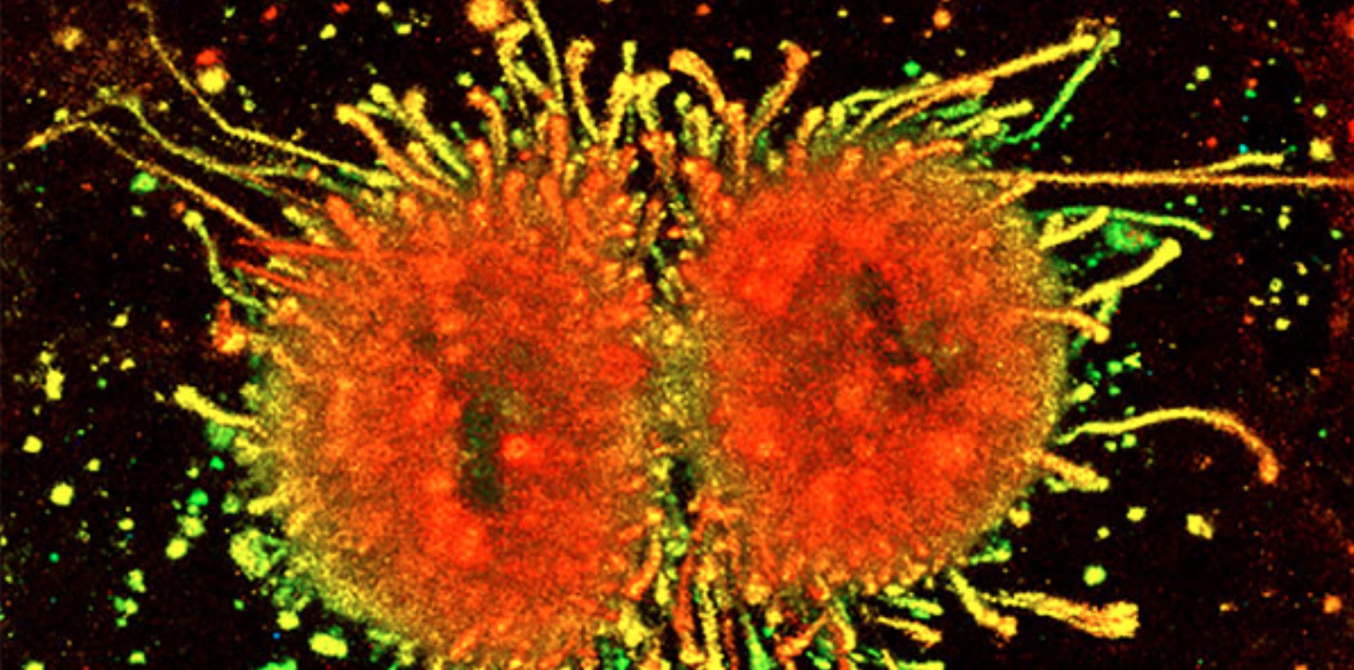 Cell Mol Life Sci：细胞外囊泡作为天然信号的载体可以帮助黑色素瘤细胞扩散