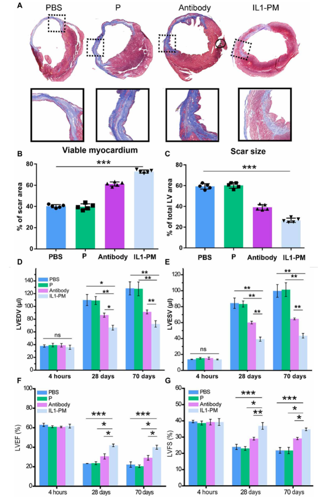 ​Science子刊：利用血小板的损伤部位归巢能力，开发出血小板微粒+IL-1β抗体药物靶向受损心脏新方法