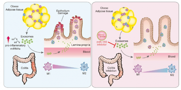 第四军医大学：内脏脂肪组织来源的外泌体在炎症性肠病中的促炎作用