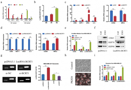 山东大学齐鲁医院：LncRNA BCRT1通过靶向miR-1303、并经外泌体诱导巨噬细胞极化促进乳腺癌进展