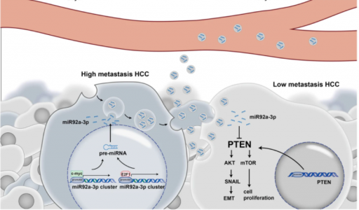 浙江大学医学院：高转移性肝癌细胞衍生的外泌体miR-92a-3p通过调节PTEN/Akt途径促进低转移肝癌细胞的EMT进程