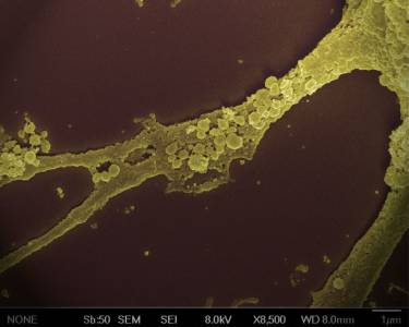 大型制药公司进军外泌体领域，用于药物递送 | Nature Biotechnology