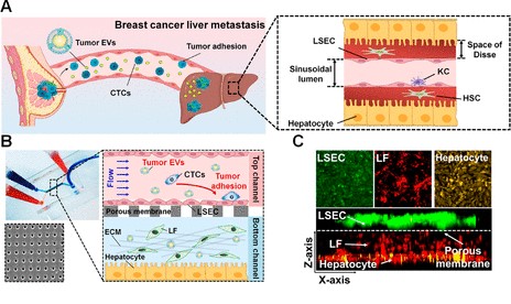科学家开发了一种人肝脏微流控芯片用于研究细胞外囊泡在乳腺癌肝转移中的作用