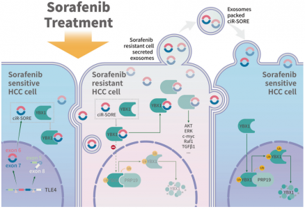 浙大邵逸夫医院：外泌体circRNA介导肝癌索拉非尼耐药的新机制
