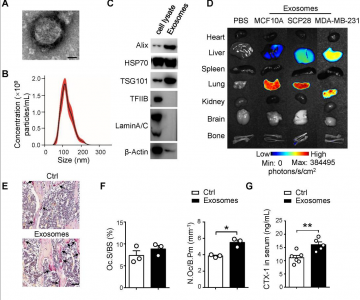 【Theranostics】乳腺癌外泌体帮助形成转移前微环境并促进肿瘤细胞骨转移