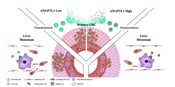 浙江大学医学院：外泌体ANGPTL1通过调节Kupffer细胞分泌模式并抑制血管渗透性来减轻结肠直肠癌肝转移