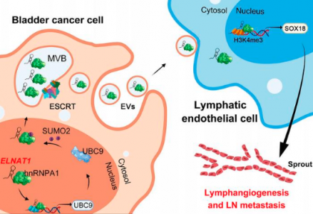 中山大学孙逸仙纪念医院 JCI：SUMO修饰在膀胱癌淋巴转移中的作用
